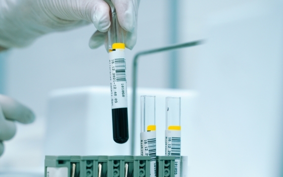 Nyírfa pollen szenzibilizáció kimutatása ImmunoCAP módszerrel