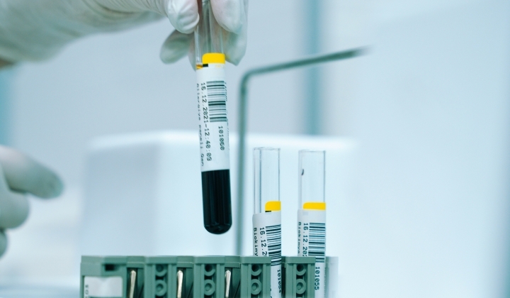 Tumormarker csomag hölgyeknek II