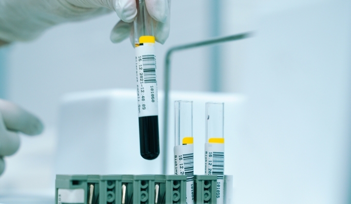 Női hormon csomag, ciklus 3-5. nap