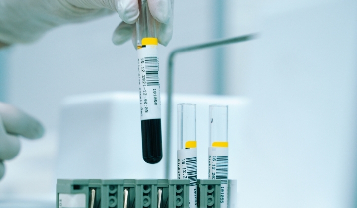 Pajzsmirigy bővített csomag