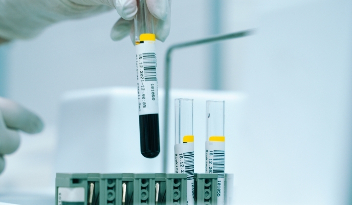 BRCA génpanel (27 emlő- és petefészekrákra hajlamosító gén vizsgálata)