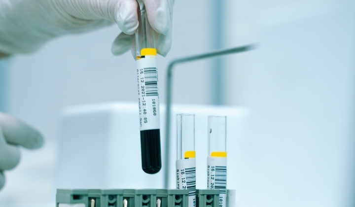 Étkezési mogyoró (törökmogyoró) szenzibilizáció kimutatása ImmunoCAP módszerrel