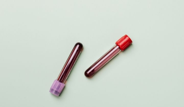 Celluláris immunstatus NK funkció méréssel